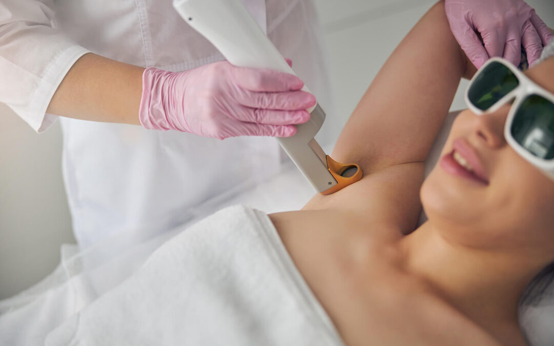 The Advantages of Laser Hair Removal