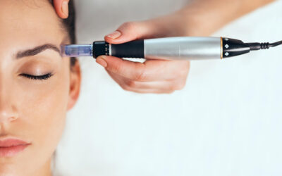 The Benefits of Microneedling for Skin Rejuvenation