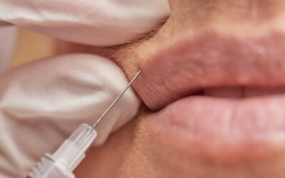 Dermal Fillers at Now You Glow