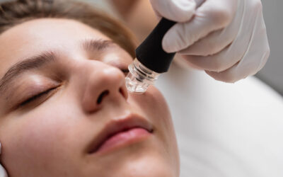 Microneedling Facial Fitness Is the Workout Your Skin Didn’t Know It Needed